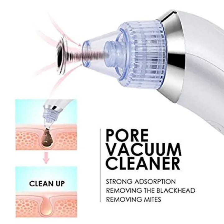 Derma Suction Blackhead Remover Pore Cleaning Device With Vacuum Action Face Pore Cleaner Facial Beauty Equipment (cell Operated)